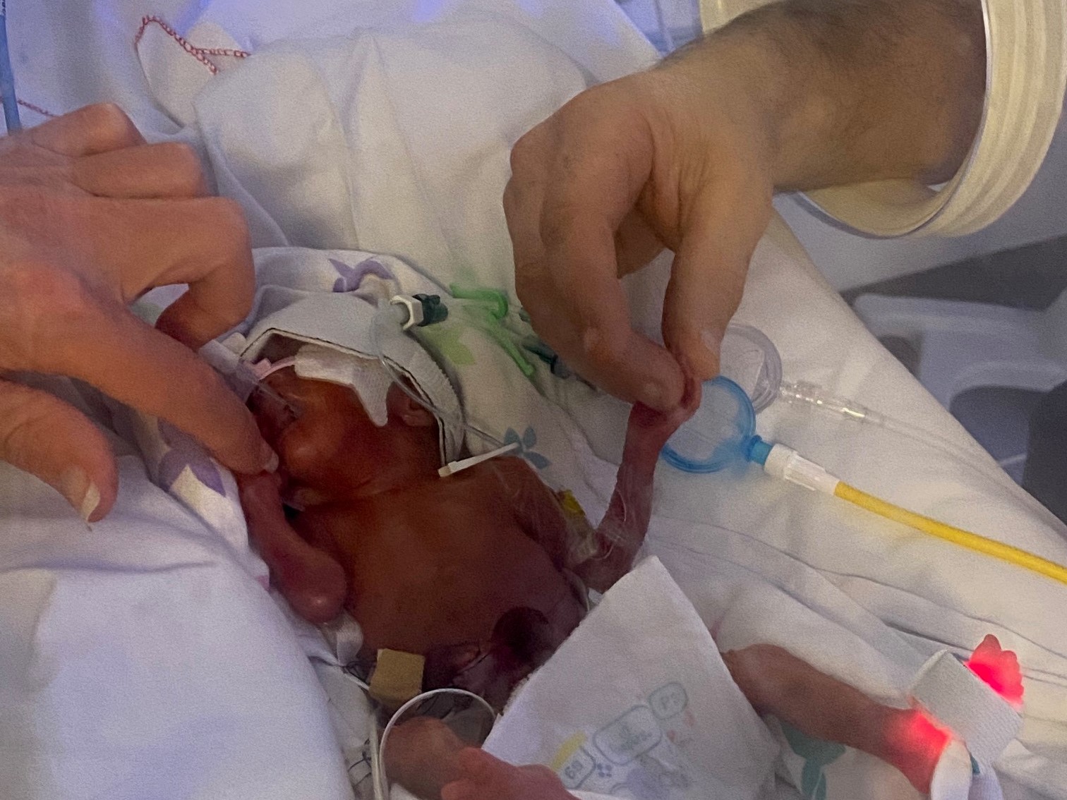 Millie's parents hold her hands in NICU